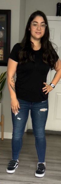 After image of weight loss surgery